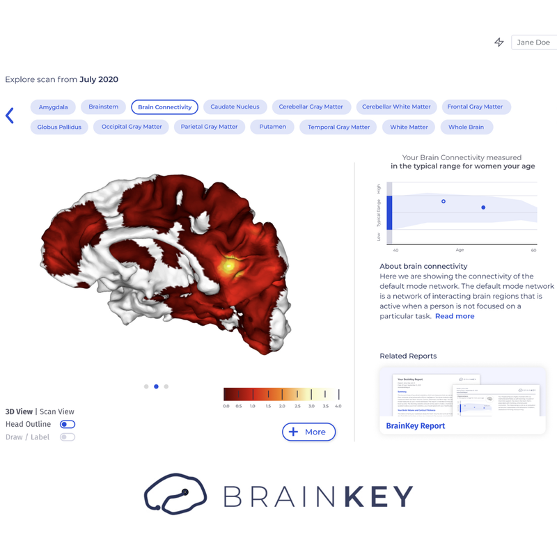 BrainKey RestingState fMRI.png