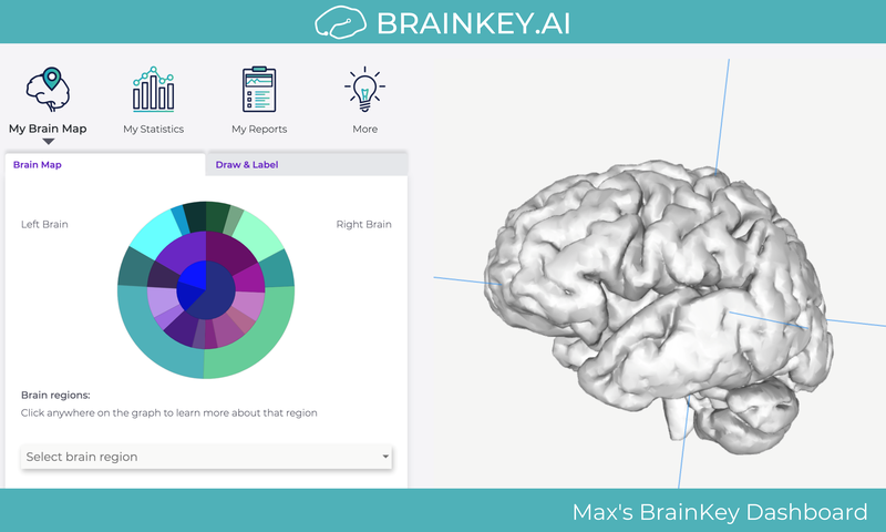 BrainKey.Max.Ibel(1).png