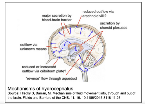 Mechanisms of hydrocephalus Source: Hladky S, Barran, M. Mechanisms of fluid movement into, through and out of the brain. Fluids and Barriers of the CNS. 11. 16. 10.1186/2045-8118-11-26.