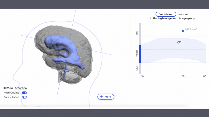 nph gif brainkey.gif